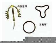上环图片