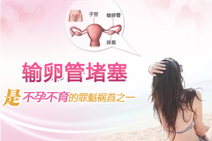 输卵管堵塞图片