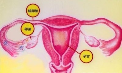 巧克力囊肿图片