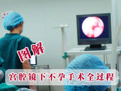宫腔镜图片