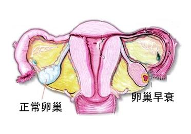 卵巢早衰图片