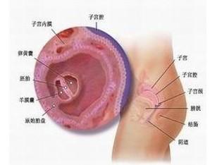 子宫内膜炎图片